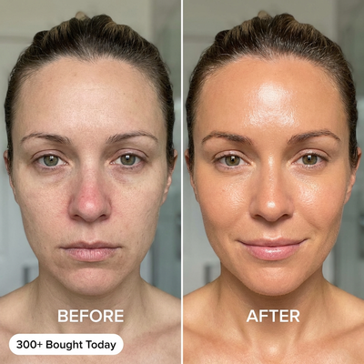 Visibly Younger, Glowing Skin in 4 Weeks. From Within.