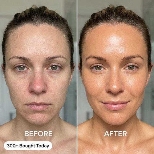 Visibly Younger, Glowing Skin in 4 Weeks. From Within.