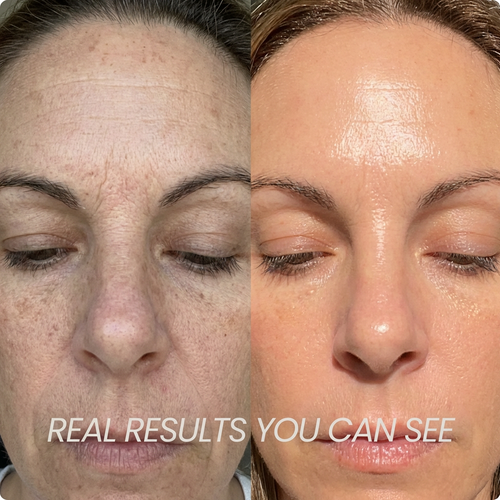 Visibly Younger, Glowing Skin in 4 Weeks. From Within.